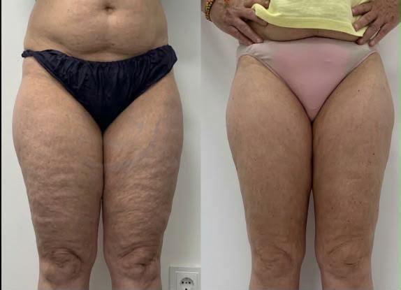 NEW-BODY00006